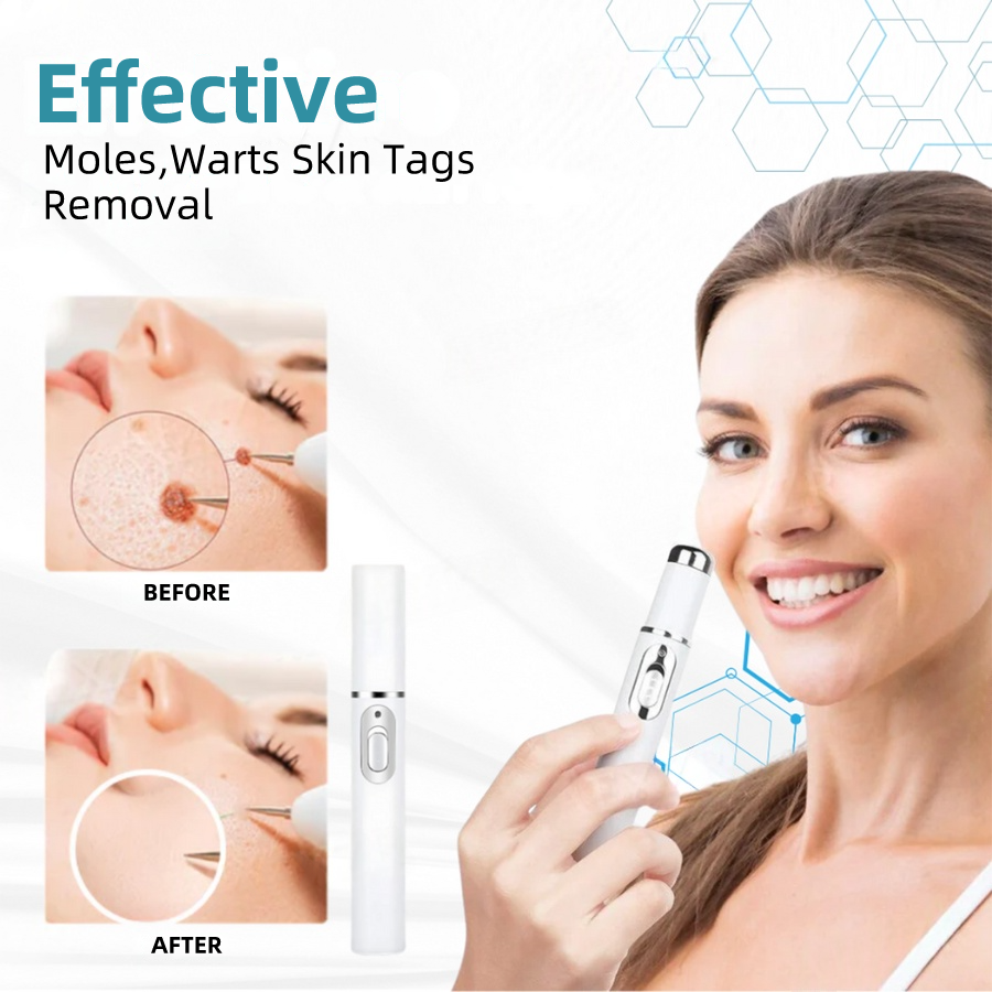 ๐๐๐ฌ๐ฌ๐๐๐ฆยฎ Medical-Grade Laser Pen ๐ (Powered by COโ laser technology โ effectively removes moles, warts, skin tags, pigmentation spots, and other skin imperfections)