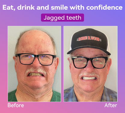 𝐉𝐚𝐬𝐬𝐞𝐞𝐦® Latest Premium Comfort Dentures🏆 (High-End Dentures, Easy to Wear - Limited Time 70% Discount)🔥