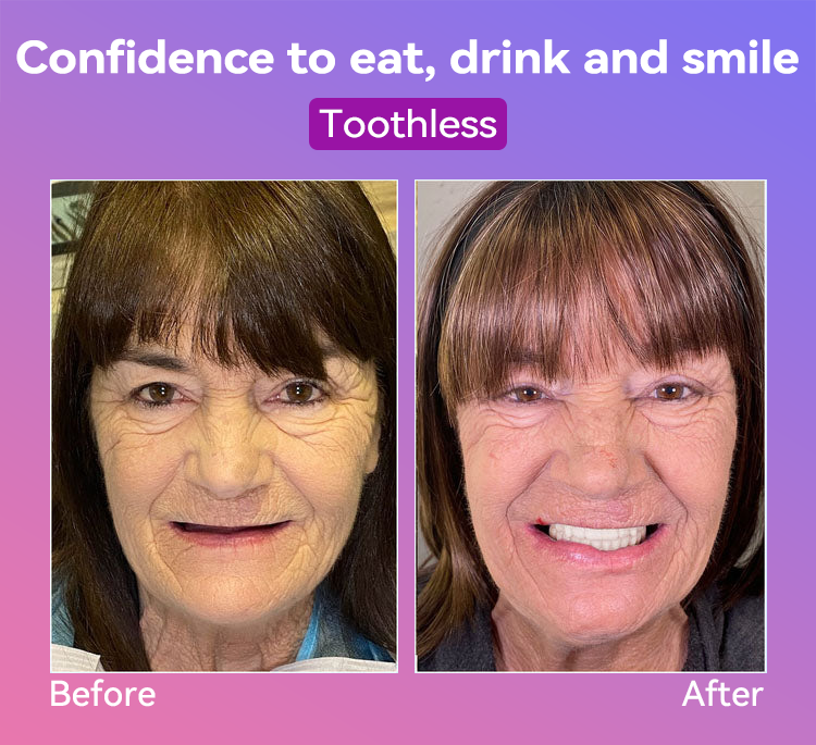 𝐉𝐚𝐬𝐬𝐞𝐞𝐦® Latest Premium Comfort Dentures🏆 (High-End Dentures, Easy to Wear - Limited Time 70% Discount)🔥