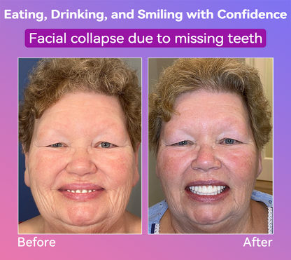 𝐉𝐚𝐬𝐬𝐞𝐞𝐦® Latest Premium Comfort Dentures🏆 (High-End Dentures, Easy to Wear - Limited Time 70% Discount)🔥