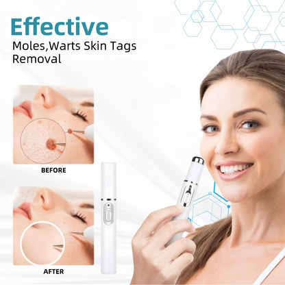 𝐉𝐚𝐬𝐬𝐞𝐞𝐦® Medical-Grade Laser Pen 🚚 (Powered by CO₂ laser technology – effectively removes moles, warts, skin tags, pigmentation spots, and other skin imperfections)