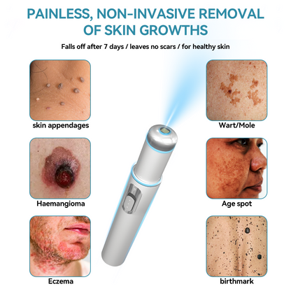 𝐉𝐚𝐬𝐬𝐞𝐞𝐦® Medical-Grade Laser Pen 🚚 (Powered by CO₂ laser technology – effectively removes moles, warts, skin tags, pigmentation spots, and other skin imperfections)